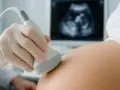 Ginekolog wykonuje USG brzucha, pokazując obraz płodu na ekranie. To ważny moment, być może właśnie 6 tydzień ciąży.