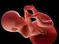 Płód w 25 tygodniu ciąży, zwinięty w kłębek, z dłońmi przy twarzy. Rozwój trwa.