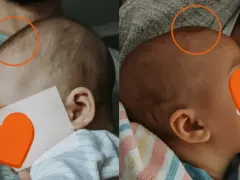 Dwa ujęcia głowy noworodka, pokazujące jego delikatne włosy i uszy.