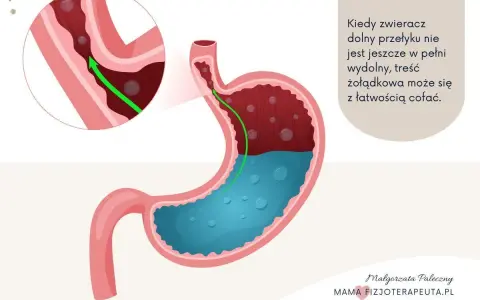 Ilustracja pokazuje żołądek i przełyk, wyjaśniając mechanizm refluksu ukrytego u niemowlaka.