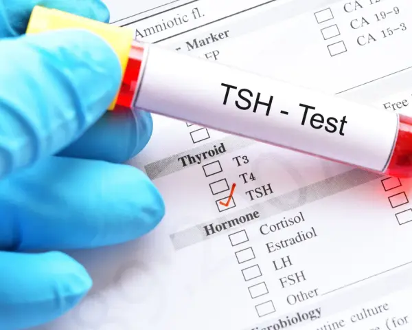Ręka w niebieskiej rękawiczce trzyma probówkę z napisem "TSH - Test". Na papierze zaznaczono TSH, co może oznaczać badanie w ciąży.