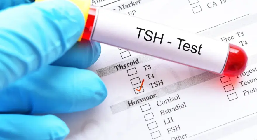 Ręka w niebieskiej rękawiczce trzyma probówkę z napisem "TSH - Test". Na papierze zaznaczono TSH, co może oznaczać badanie w ciąży.