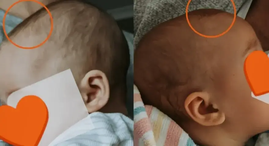 Dwa ujęcia głowy noworodka, pokazujące jego delikatne włosy i uszy.