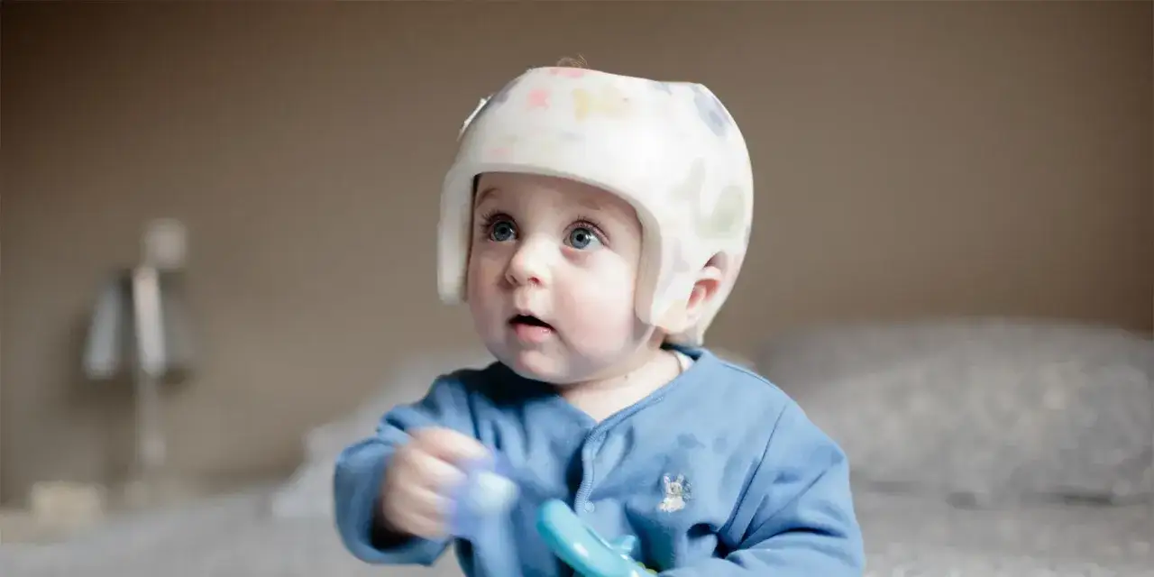 Niebieskooki maluch w kasku z zabawnymi wzorami, który koryguje dziwny kształt głowy u dziecka.